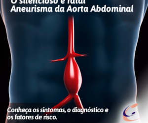 aneurisma-aorta-abdominal